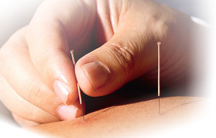 Acupuncture For Bellmore Acupuncture Clinic